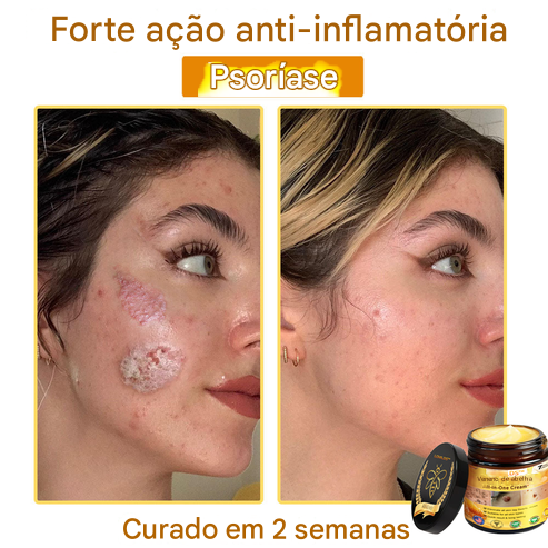 LOVILDS™ Creme Tudo-em-Um com Veneno de Abelha – Aprovado por Dermatologistas dos EUA