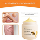 Creme Anti-Varizes ApisRx | Alívio visível em apenas 7 dias (Somente HOJE!)