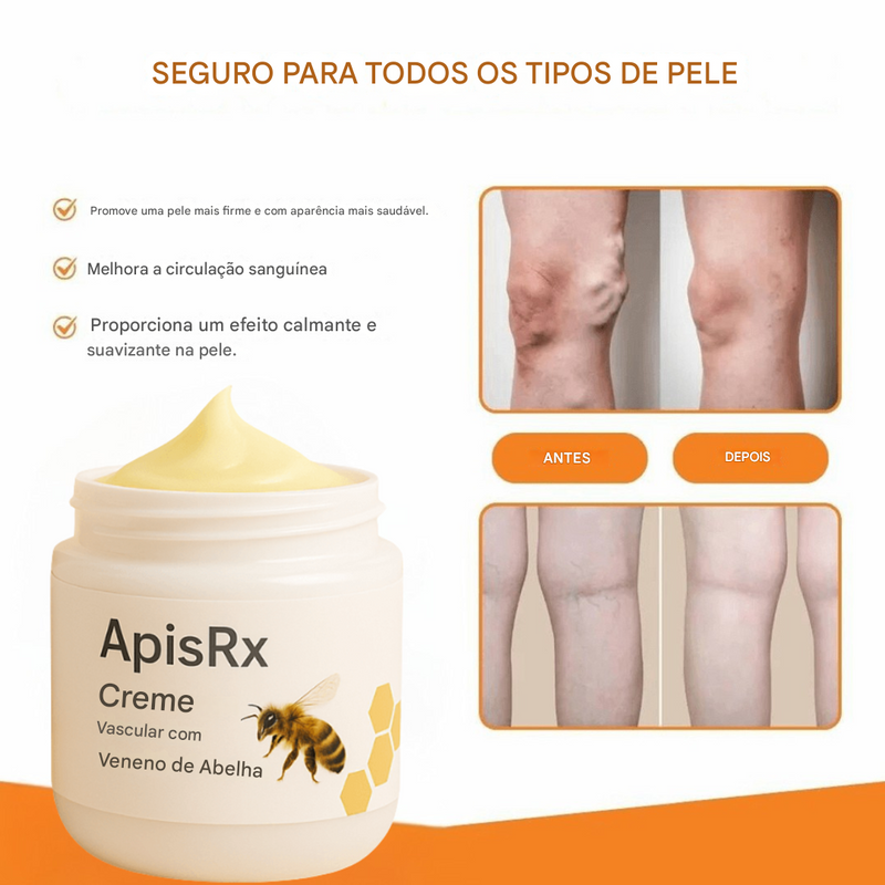 Creme Anti-Varizes ApisRx | Alívio visível em apenas 7 dias (Somente HOJE!)