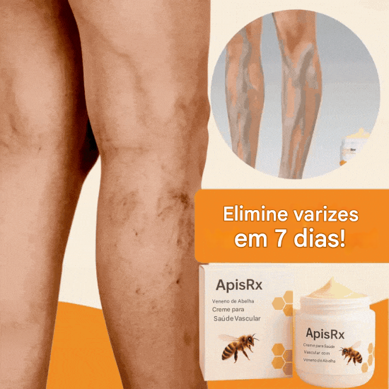 Creme Anti-Varizes ApisRx | Alívio visível em apenas 7 dias (Somente HOJE!)
