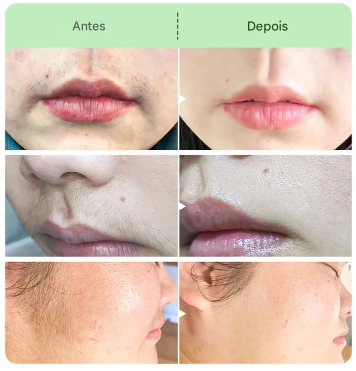 Kit de creme depilatório (COMPRE 1 LEVE 2)