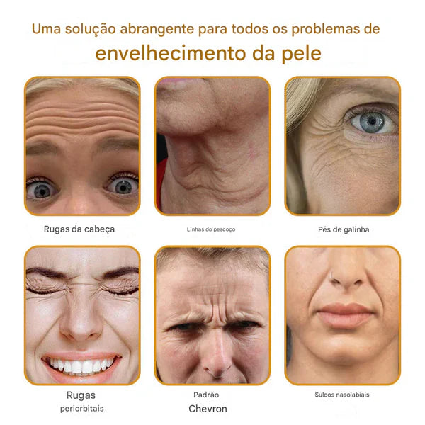 Creme removedor de rugas Botox Bee Venom - 🐝  (Compre 1 Leve 2)