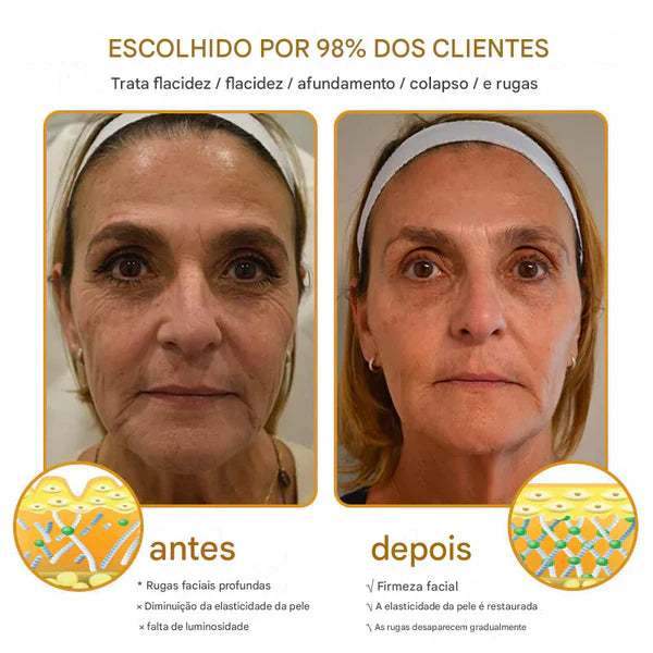 Creme removedor de rugas Botox Bee Venom - 🐝  (Compre 1 Leve 2)