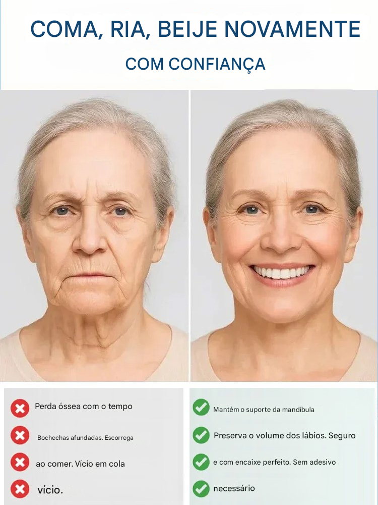 Conjunto de prótese total com suporte ósseo (Somente HOJE!)🔥