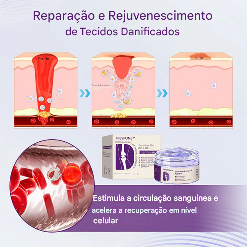 Gel para dor Misspone™ com curcumina e óleo de emu (Somente HOJE!)