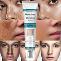 Creme de Beleza Removedor de Manchas