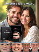 Conjunto de prótese total com suporte ósseo (Somente HOJE!)🔥