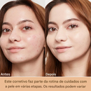 Base em Bastão (Compre 1 Leve 2)