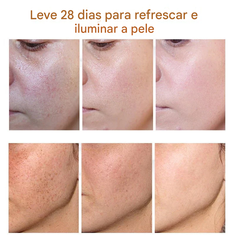Creme de Beleza Removedor de Manchas