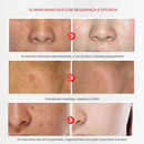 Creme de Beleza Removedor de Manchas