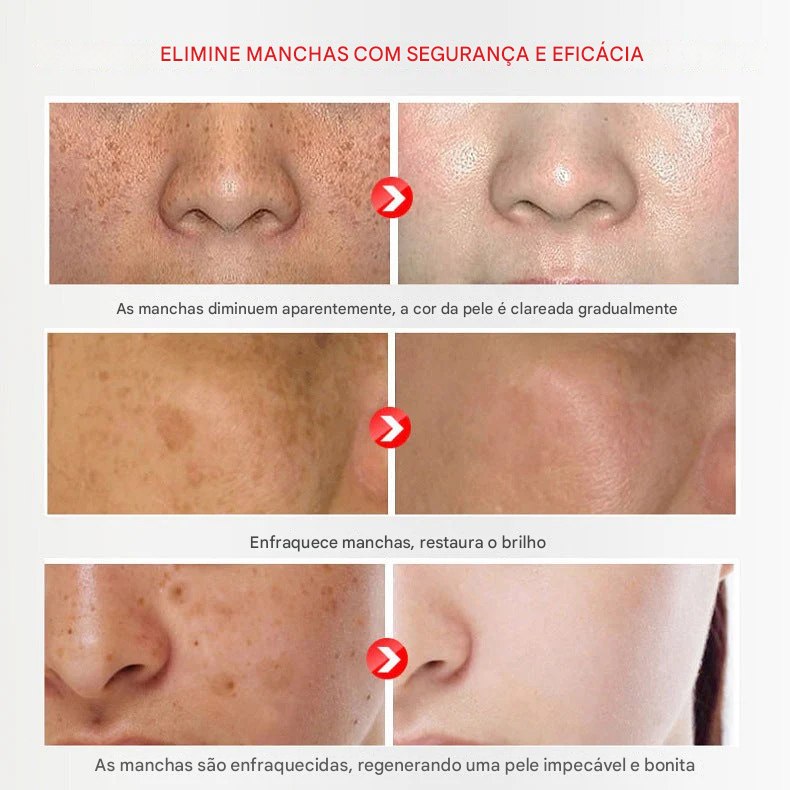 Creme de Beleza Removedor de Manchas