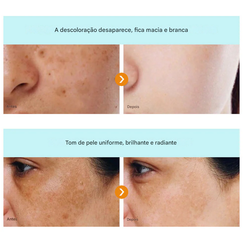 Creme de Beleza Removedor de Manchas