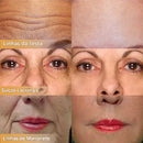 Dermaluxe Peptide - Creme Facial Firmador (Somente HOJE!)