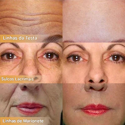 Dermaluxe Peptide - Creme Facial Firmador (Somente HOJE!)