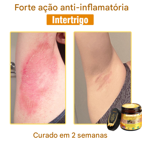 LOVILDS™ Creme Tudo-em-Um com Veneno de Abelha – Aprovado por Dermatologistas dos EUA