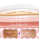 Fita de pele com microagulhas Timilk® HyaRepair (Somente HOJE!)