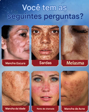 Creme de Beleza Removedor de Manchas