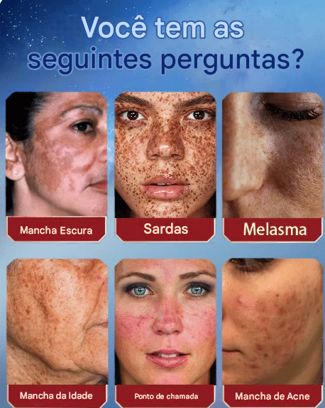 Creme de Beleza Removedor de Manchas